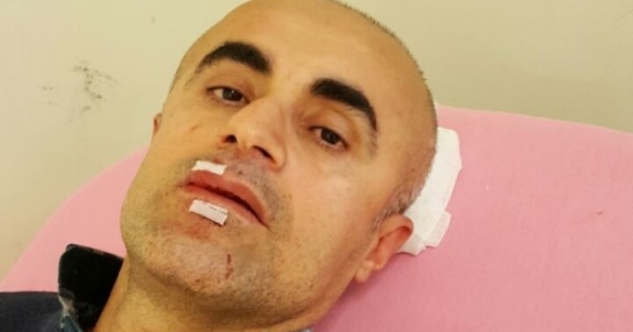 'Bayılmışım, öldü diye bıraktılar!'