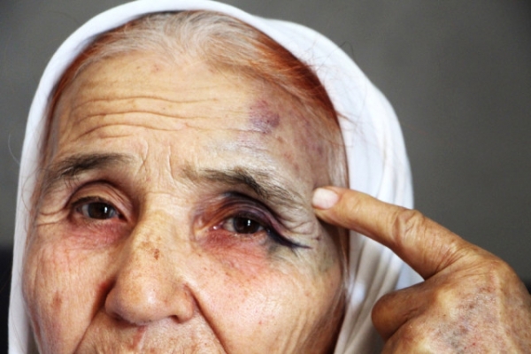 Antalya'da 80 Yaşındaki Kadını, Eski Gelinini Sokak Ortasında Dövdü