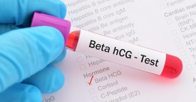 Hamile bir kadında beta hCG değeri kaç olmalı?