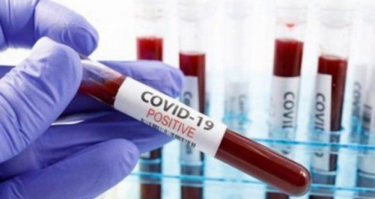 Antalya ve ilçelerindeki Covid-19 hastaları için yeni karar