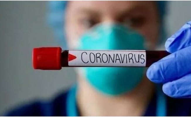 Beklenen rapor yayınlandı! ‘Koronavirüs insan yapımı’
