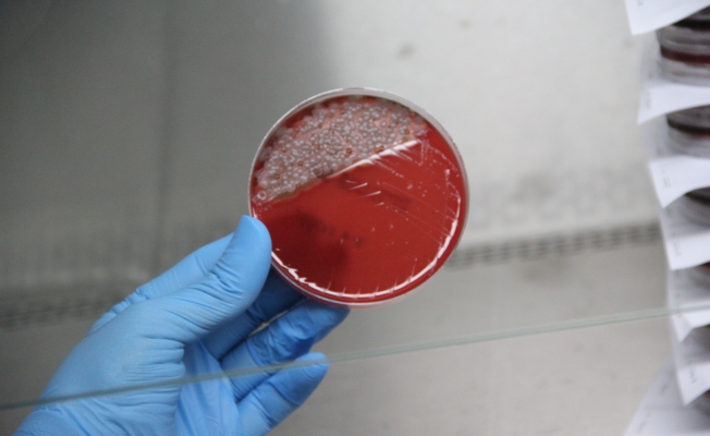 Uzun süre kullanılan maskedeki bakteriler laboratuvarda gözler önüne serildi