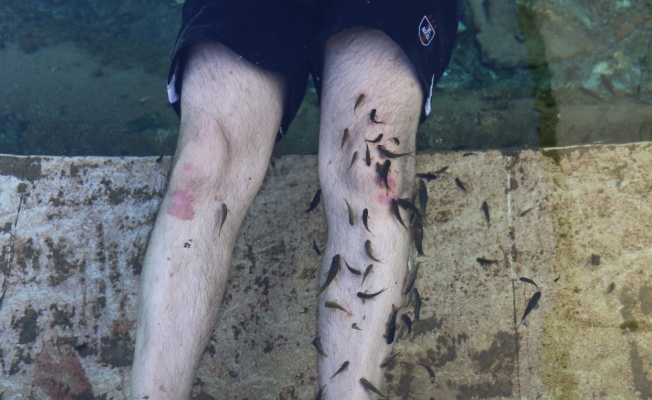 Dünyada benzerleri yok, doktor balıklar şifa saçıyor