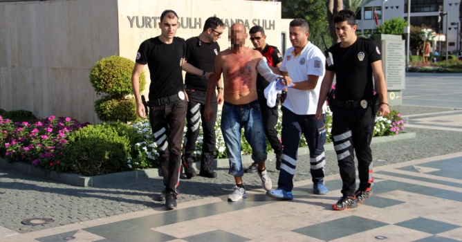 Cinnet getiren kişi jiletle kendini yaraladı 