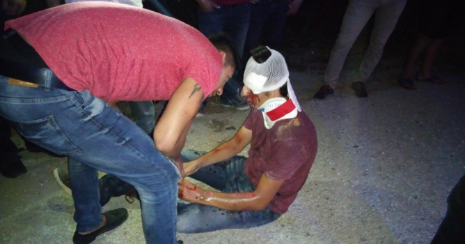 Düğüne giderken hastanelik oldu