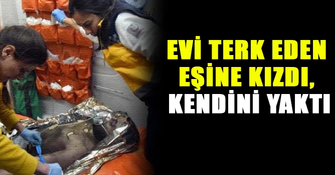 Evi Terk Eden Eşine Kızdı, Kendini Yaktı