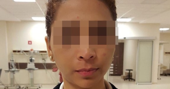 İç organlarında 78 adet kokain kapsülüyle yakalandı