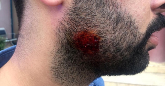 Müdürün yanağını ısırdı